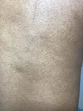 incognitobdy on StripChat